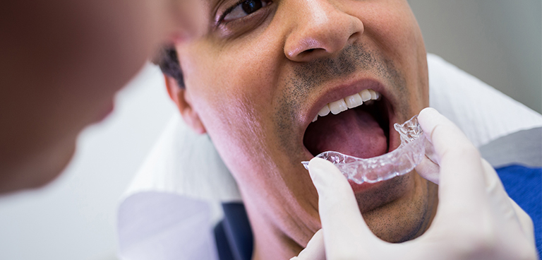 Teeth-alignment