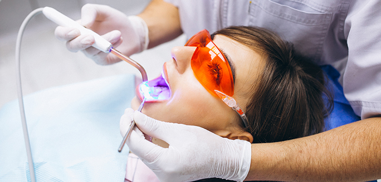 Teeth-whitening02