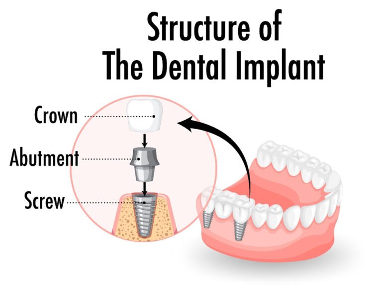 Digital-Dentistry-in-Vadodara
