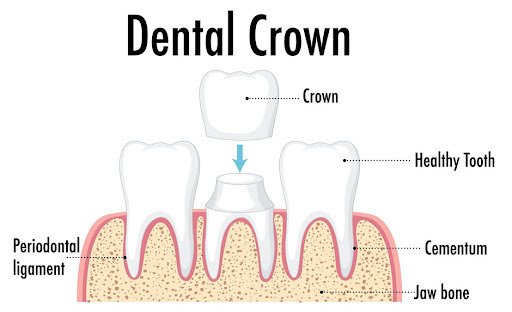 Cosmetic-Dentist-Vasna