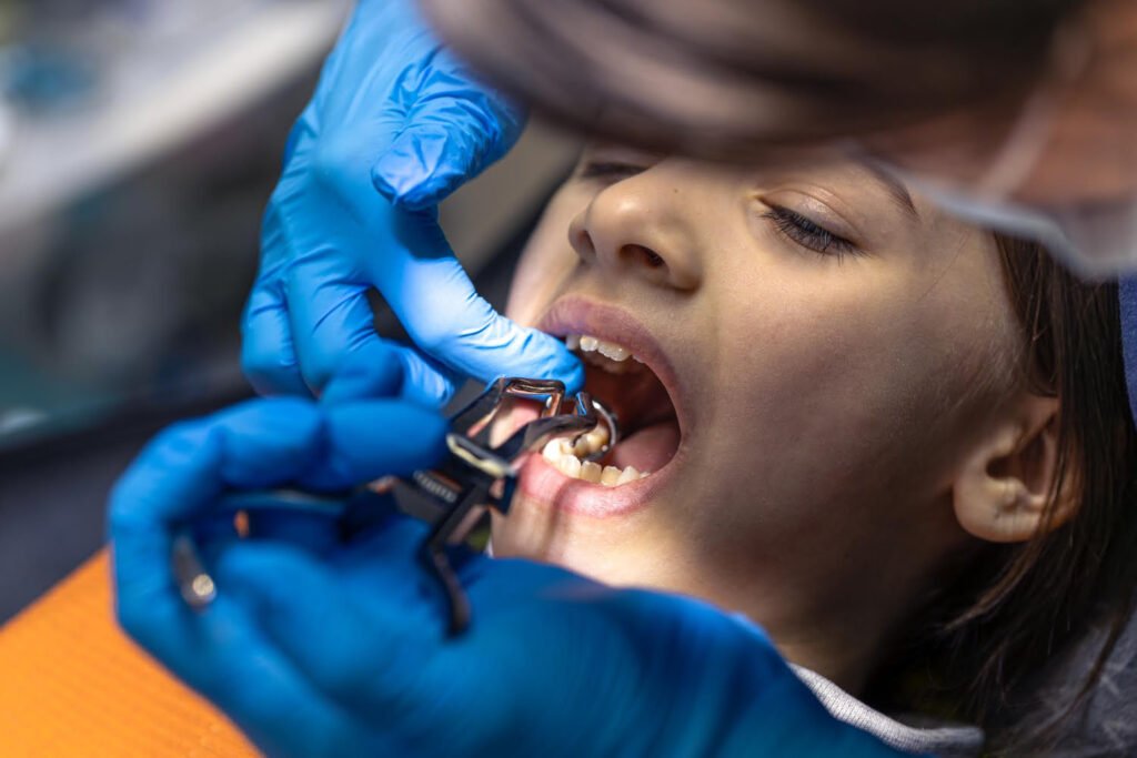 Missing Teeth Vadodara