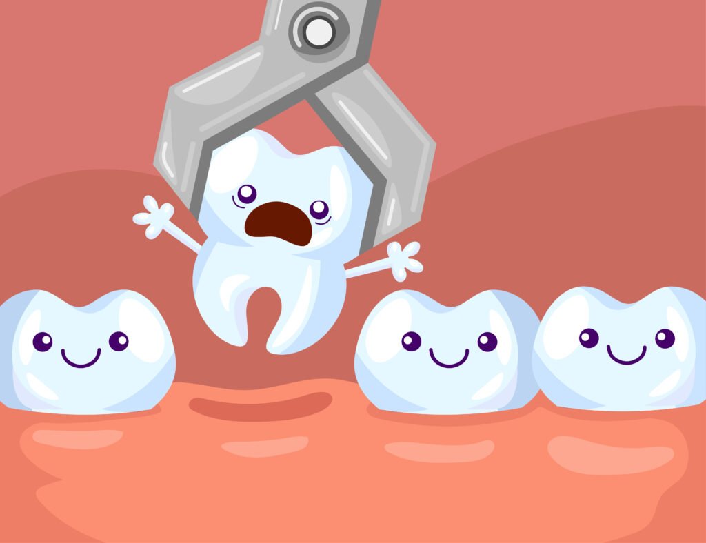 Tooth Extraction