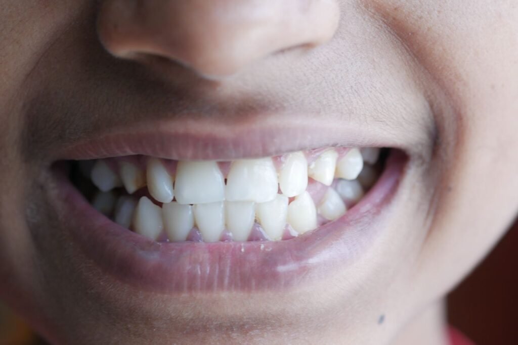 Invisalign Vasna