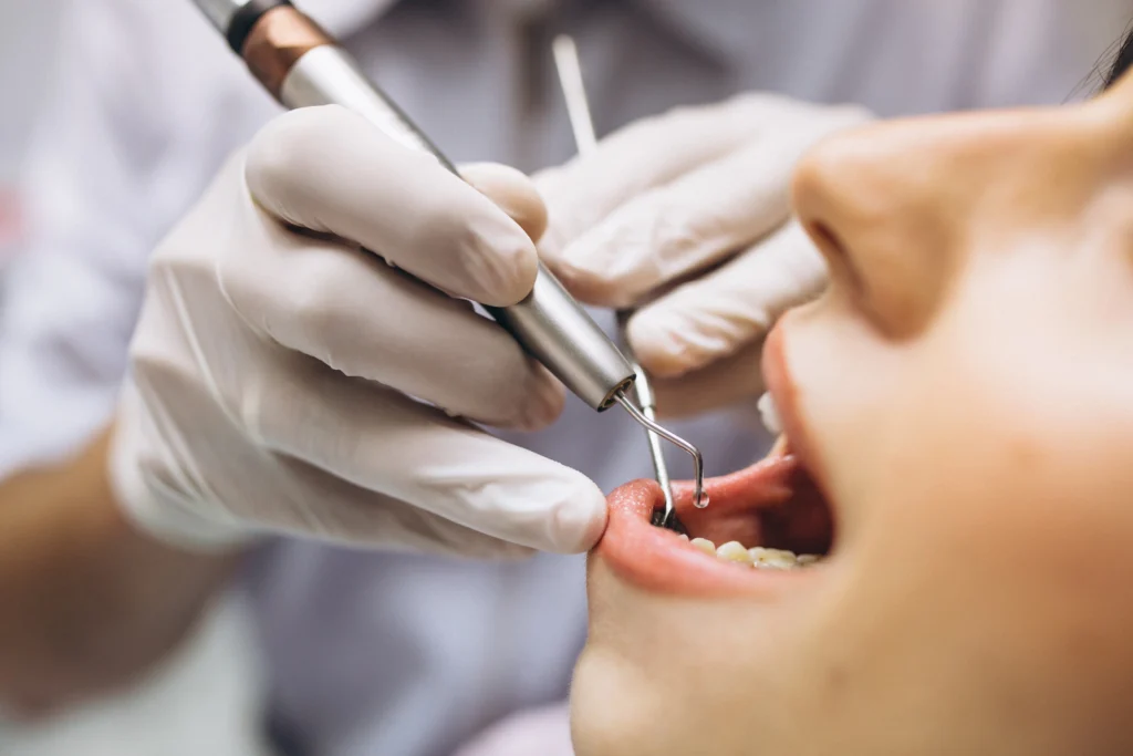 What Should I Ask a Dentist in Bhayli Before Starting Dental Treatment?