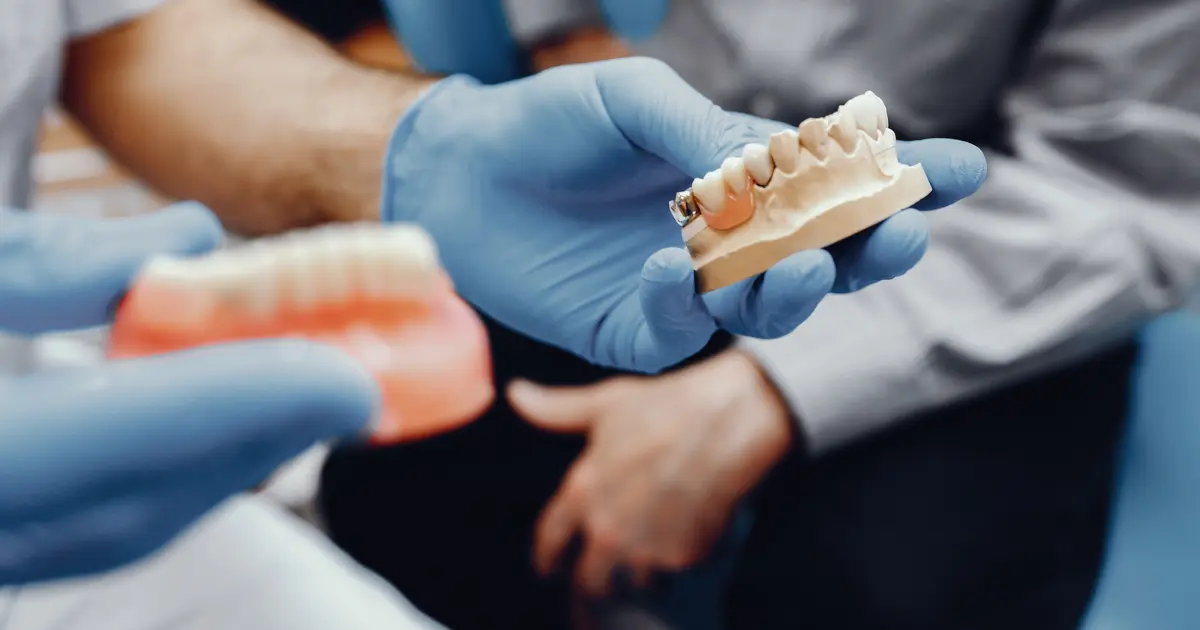 What Factors Should Be Considered Before Choosing Dental Implants in Bhayli?